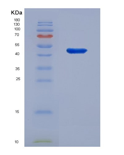Human TNFRSF25 (Tumor Necrosis Factor Receptor Superfamily Member 25) - Recombinant Protein