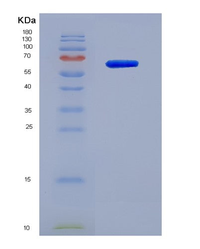 Human IFNAR2 (Interferon Alpha/Beta Receptor 2) - Recombinant Protein