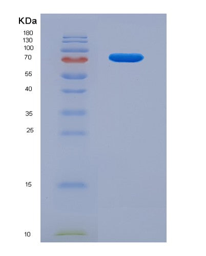 Human IL10RB (Interleukin-10 Receptor Subunit Beta) - Recombinant Protein