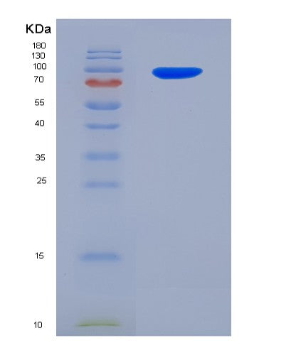 Human POSTN (Periostin) - Recombinant Protein