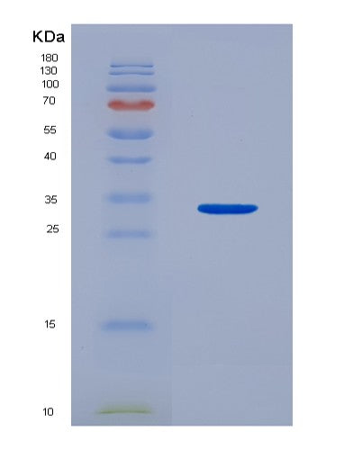 Human BTN1A1 (Butyrophilin Subfamily 1 Member A1) - Recombinant Protein