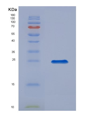 Mouse Tslp (Thymic Stromal Lymphopoietin) - Recombinant Protein