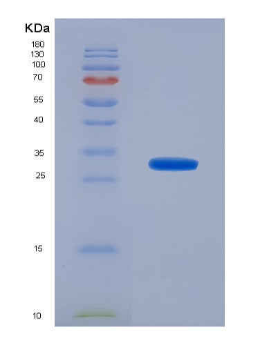Human FCGR2A (Low Affinity Immunoglobulin Gamma Fc Region Receptor Ii-A) - Recombinant Protein