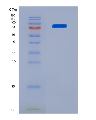 Human TNFRSF21 (Tumor Necrosis Factor Receptor Superfamily Member 21) - Recombinant Protein