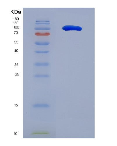 Human ICAM3 (Intercellular Adhesion Molecule 3) - Recombinant Protein