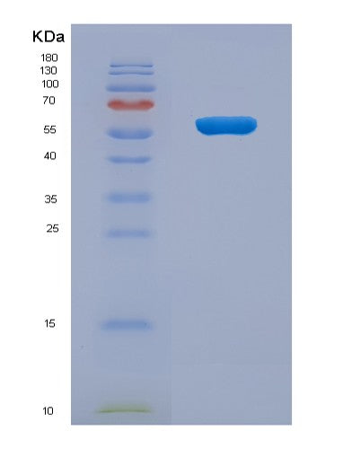 Human KLRB1 (Killer Cell Lectin-Like Receptor Subfamily B Member 1) - Recombinant Protein