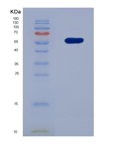 Human CD300A (Cmrf35-Like Molecule 8) - Recombinant Protein