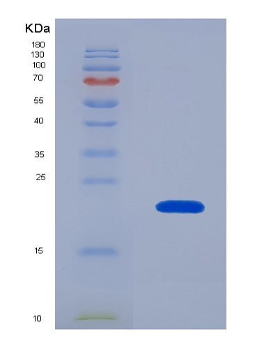 Human KITLG (Kit Ligand) - Recombinant Protein