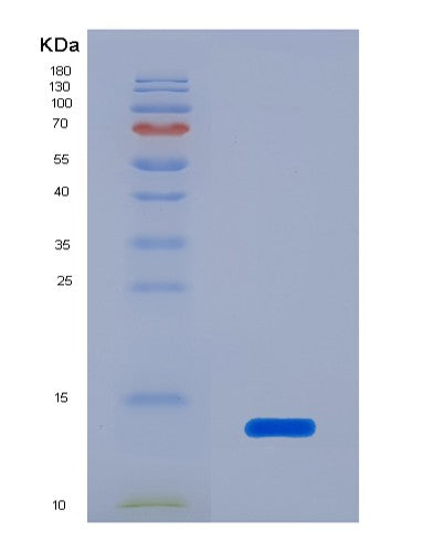 Human LAMTOR5 (Ragulator Complex Protein Lamtor5) - Recombinant Protein