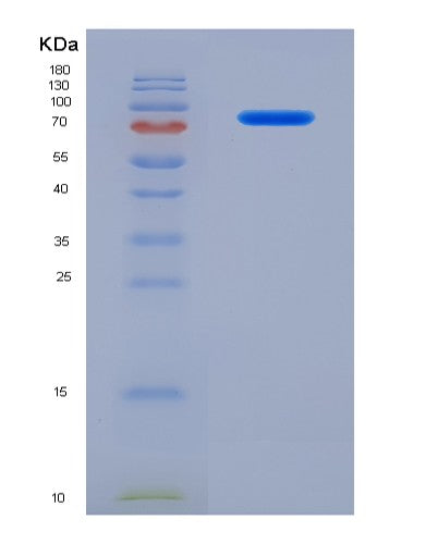 Human SERPING1 (Plasma Protease C1 Inhibitor) - Recombinant Protein