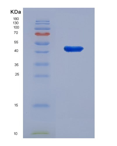 Human IL18RAP (Interleukin-18 Receptor Accessory Protein) - Recombinant Protein