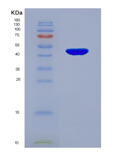 Human IL12B (Interleukin-12 Subunit Beta) - Recombinant Protein