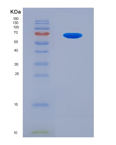 Human RSPO3 (R-Spondin-3) - Recombinant Protein