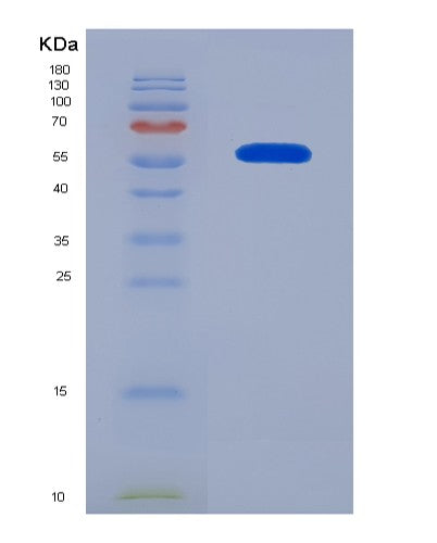 Human ICAM2 (Intercellular Adhesion Molecule 2) - Recombinant Protein
