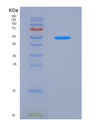 Human TNFRSF14 (Tumor Necrosis Factor Receptor Superfamily Member 14) - Recombinant Protein