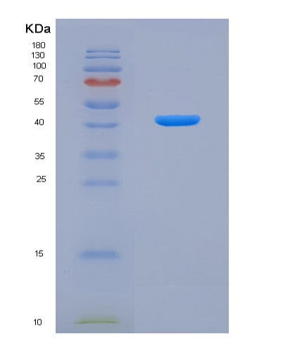 Mouse Ctsb (Cathepsin B) - Recombinant Protein