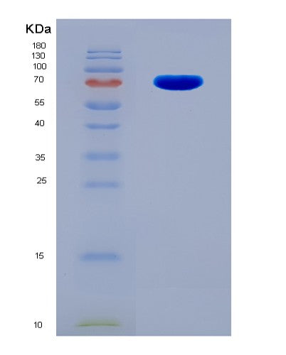 Human CRTAM (Cytotoxic And Regulatory T-Cell Molecule) - Recombinant Protein