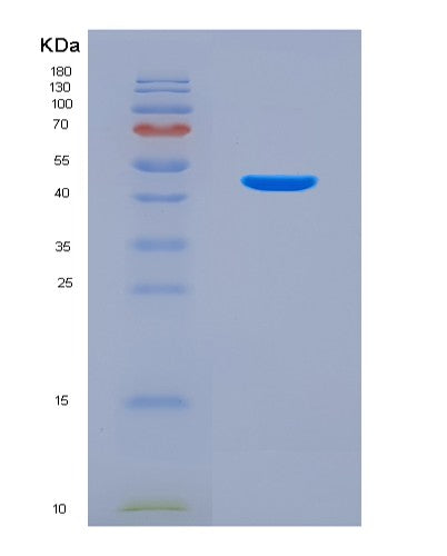 Mouse Il12b (Interleukin-12 Subunit Beta) - Recombinant Protein