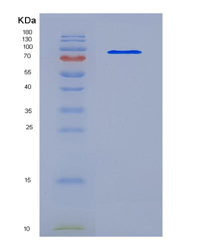 Mouse Icam1 (Intercellular Adhesion Molecule 1) - Recombinant Protein