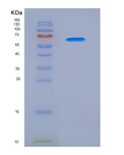 Human PSG1 (Pregnancy-Specific Beta-1-Glycoprotein 1) - Recombinant Protein