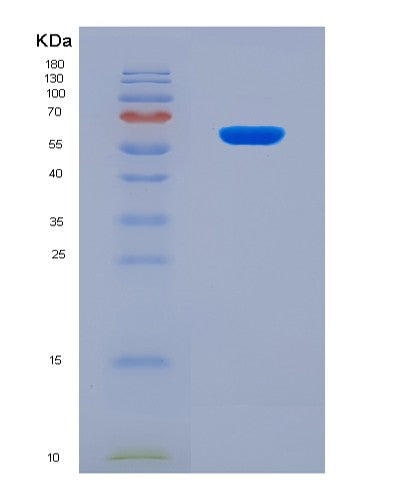 Human CSF2RA (Granulocyte-Macrophage Colony-Stimulating Factor Receptor Subunit Alpha) - Recombinant Protein