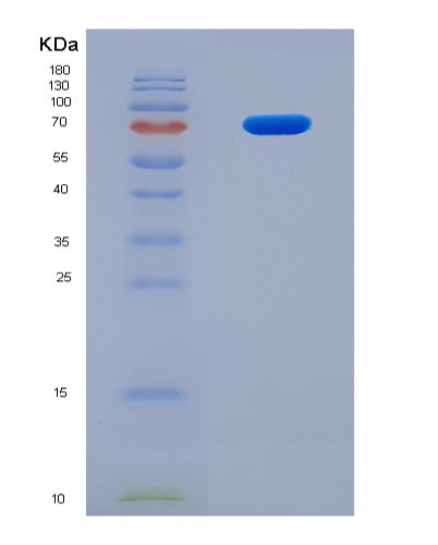 Human BPI (Bactericidal Permeability-Increasing Protein) - Recombinant Protein