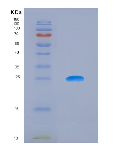 Human BTN3A3 (Butyrophilin Subfamily 3 Member A3) - Recombinant Protein