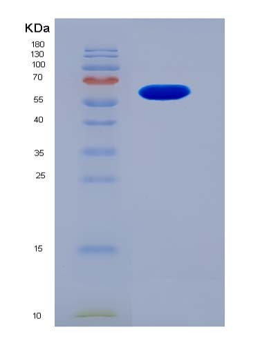 Human KIN (Dna/Rna-Binding Protein Kin17) - Recombinant Protein